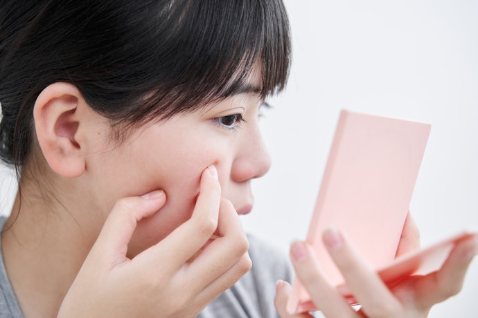 為什麼青春期會長粉刺、痘痘?