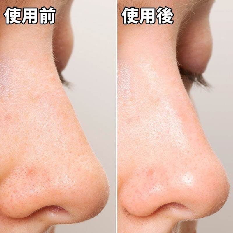 黑色妙鼻貼(女用) 7