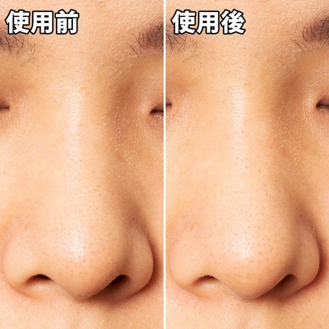 黑色妙鼻貼（女用） 8