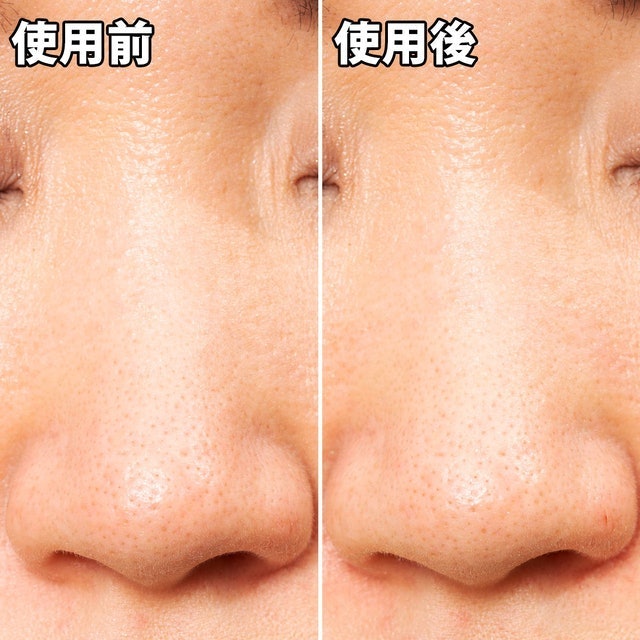 玩鼻親綠茶緊緻鼻膜 5