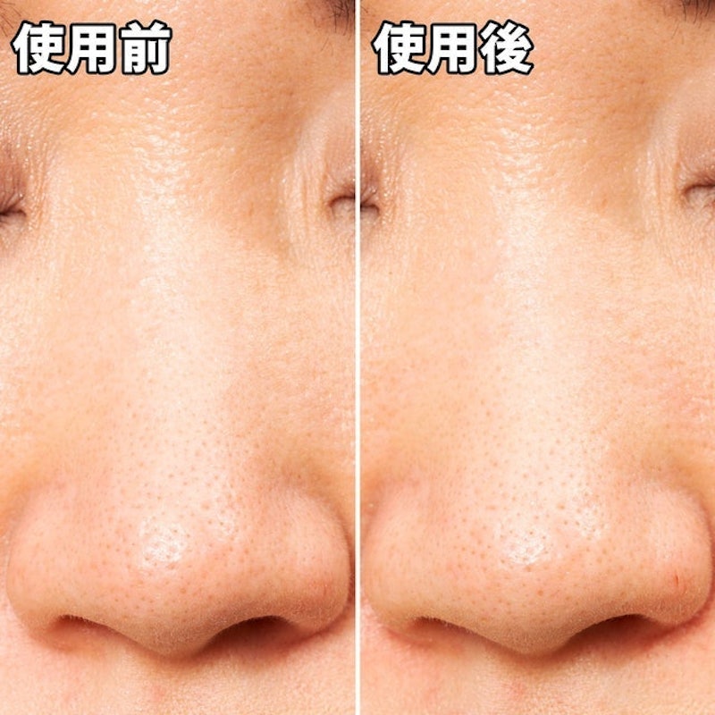 玩鼻親綠茶緊緻鼻膜 5