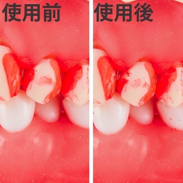 超極細 I型牙間刷 6