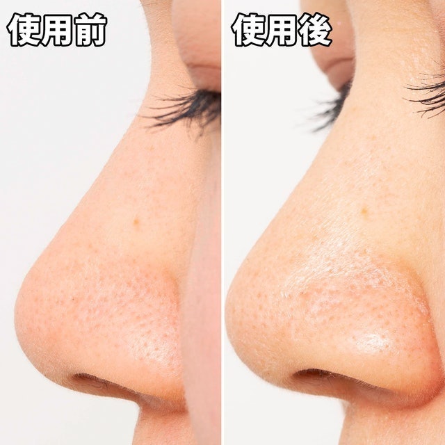 妙鼻貼（女用） 6
