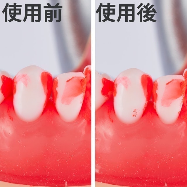 超極細 I型牙間刷 7