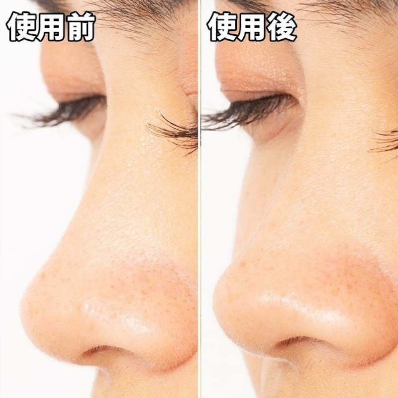 清潔毛孔黑色妙鼻貼 9