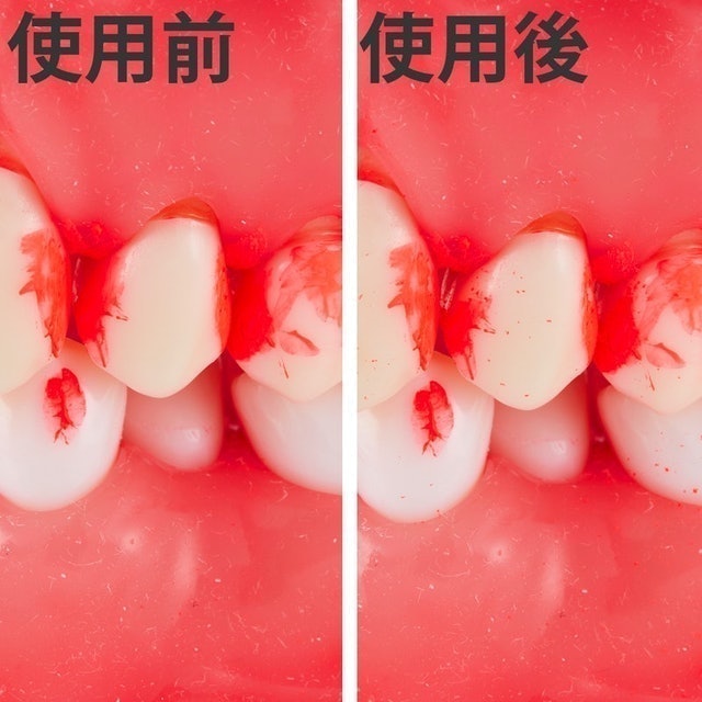 超極細 L字型牙間刷 SSSS 6