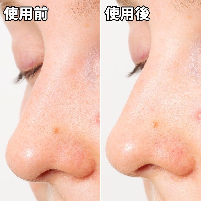 黑色妙鼻貼（女用） 6