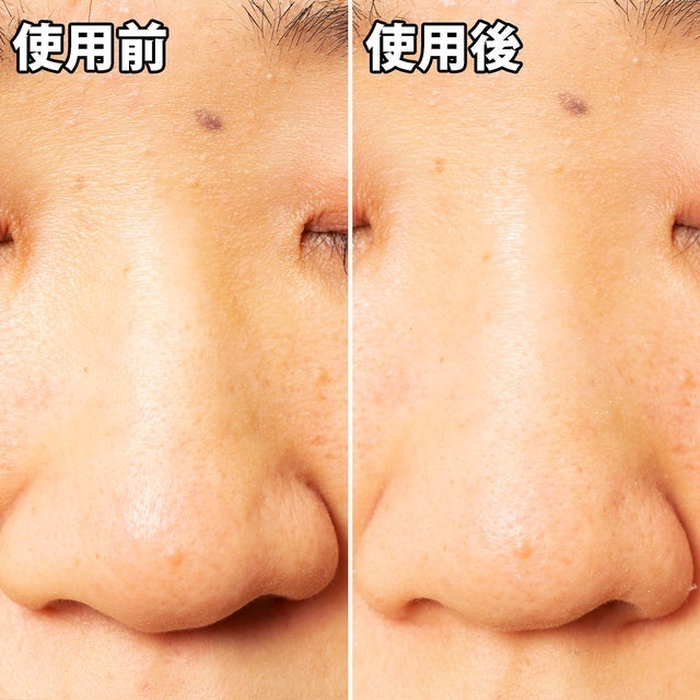 毛穴問題 凝膠型撕式鼻膜 5