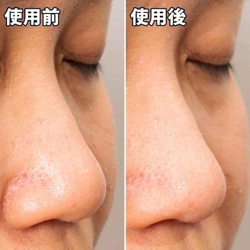 妙鼻貼(女用) 10