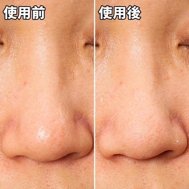 妙鼻貼（女用） 8