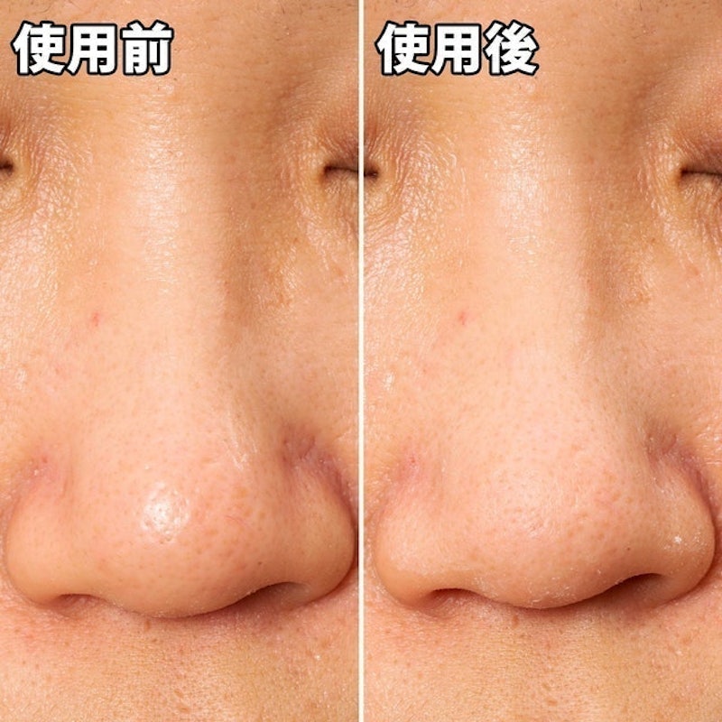 妙鼻貼(女用) 8