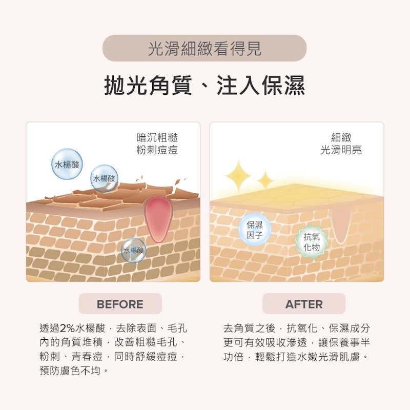 2%水楊酸身體乳 2