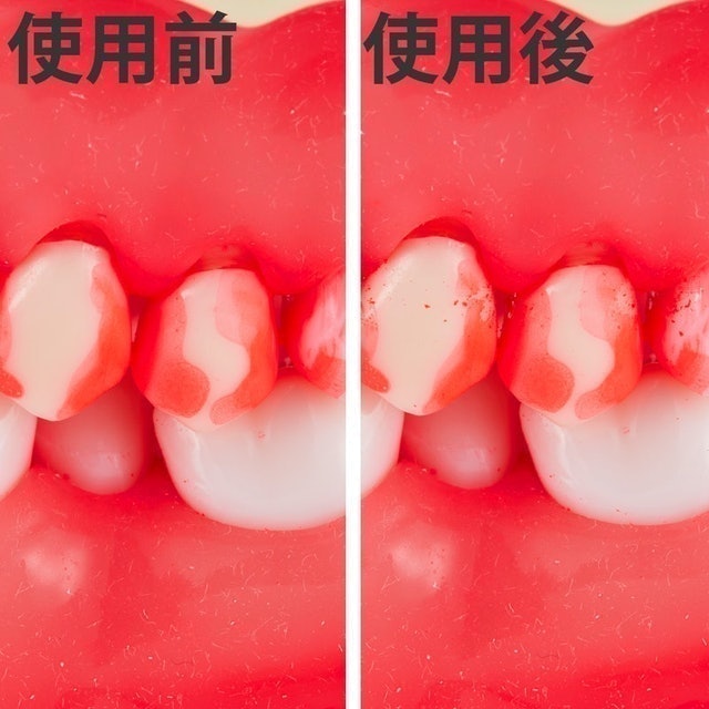 Ｌ型牙間刷 普通刷毛 6
