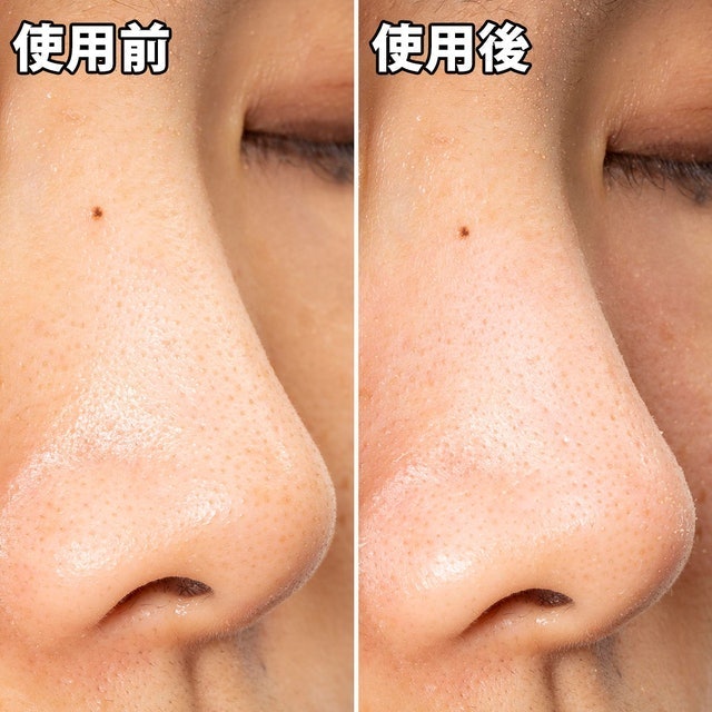 玩鼻親綠茶緊緻鼻膜 10