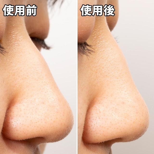 白金製藥 毛孔妙鼻貼炭貼布 7