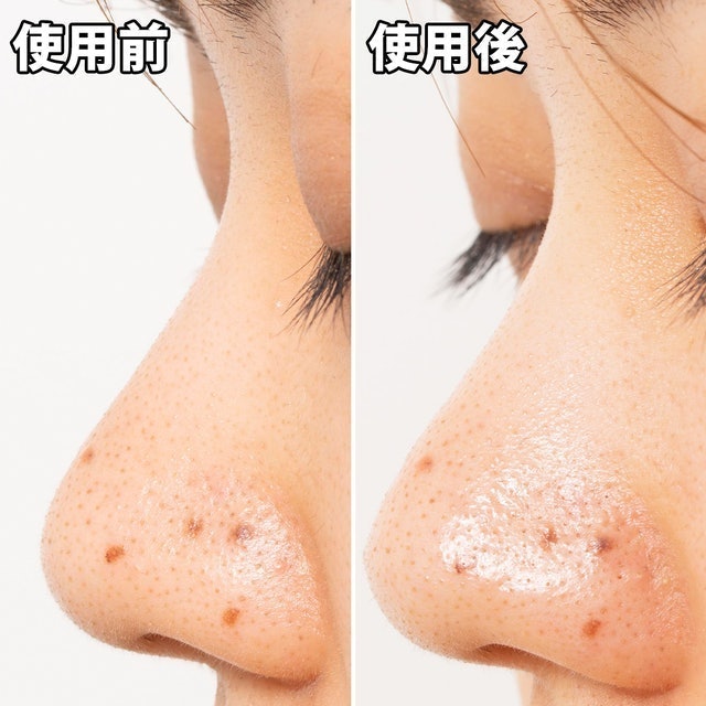 白金製藥 毛孔妙鼻貼炭貼布 9