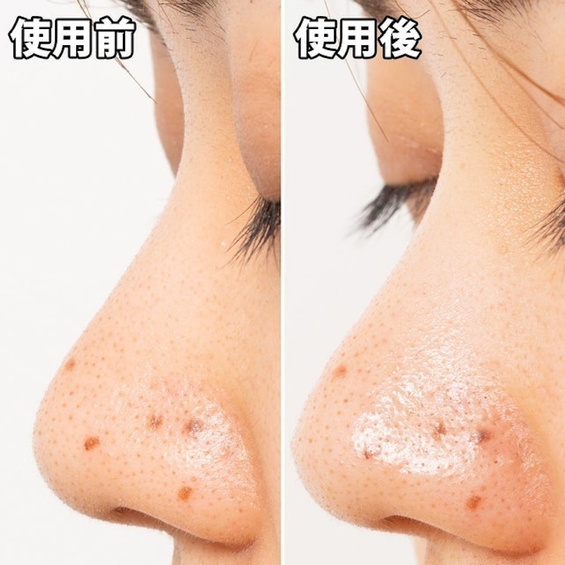 白金製藥 毛孔妙鼻貼炭貼布 9