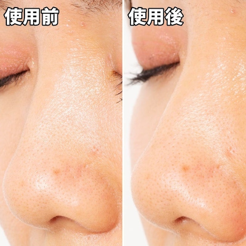 黑頭面膜 6