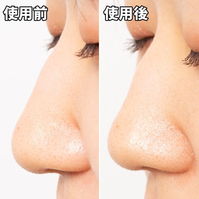 白金製藥 毛孔妙鼻貼炭貼布 6