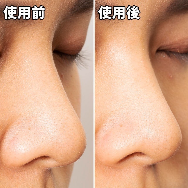 黑色妙鼻貼（女用） 10