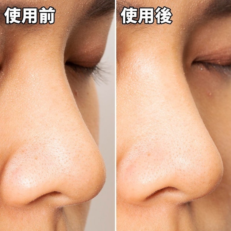 黑色妙鼻貼(女用) 10