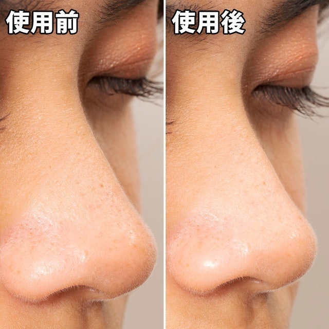 清潔毛孔黑色妙鼻貼 10