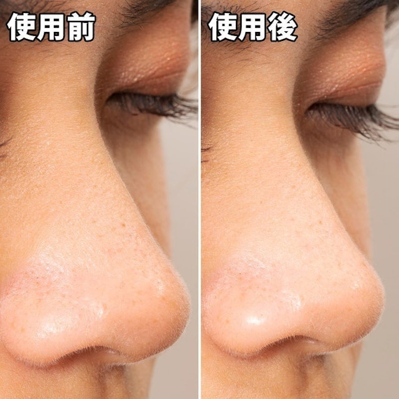 清潔毛孔黑色妙鼻貼 10