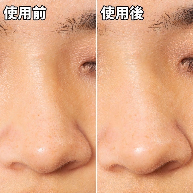 清潔毛孔黑色妙鼻貼 8
