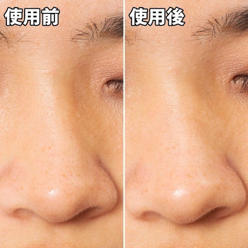 清潔毛孔黑色妙鼻貼 8