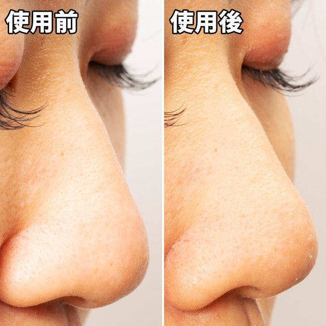 毛穴問題 凝膠型撕式鼻膜 7