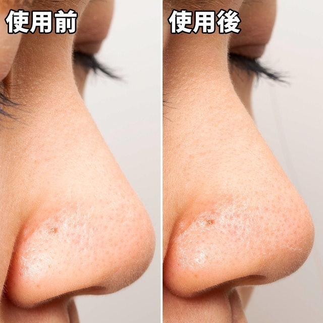 妙鼻貼（女用） 7