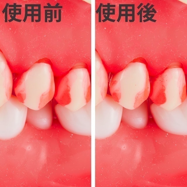 DENT.EX 牙間刷 4S 6