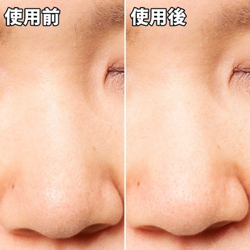 妙鼻貼(女用) 5