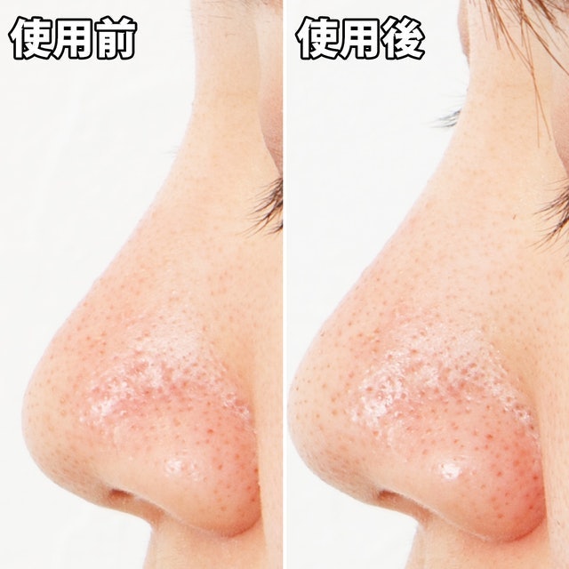 黑頭面膜 9