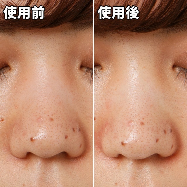 毛穴問題 凝膠型撕式鼻膜 8