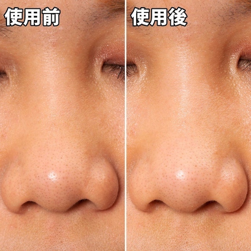 Pore’s Care 黑炭妙鼻貼 8