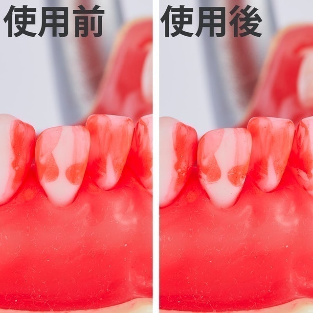 Ｌ型牙間刷 普通刷毛 7