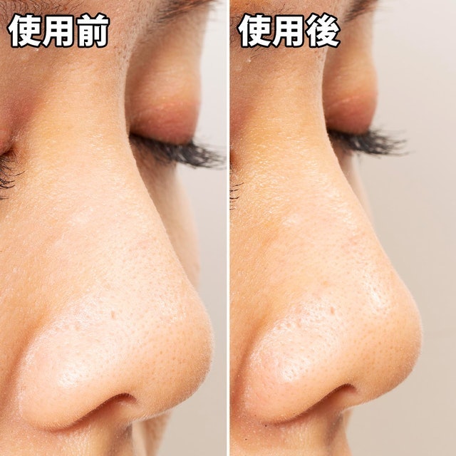 黑頭面膜 7