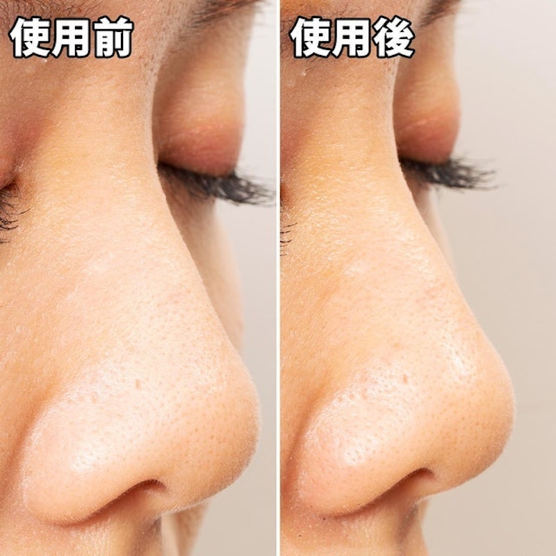 黑頭面膜 7