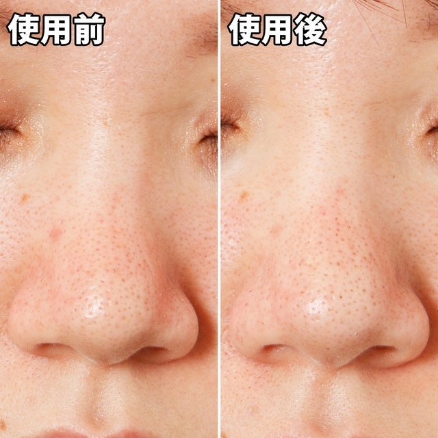 黑頭面膜 8