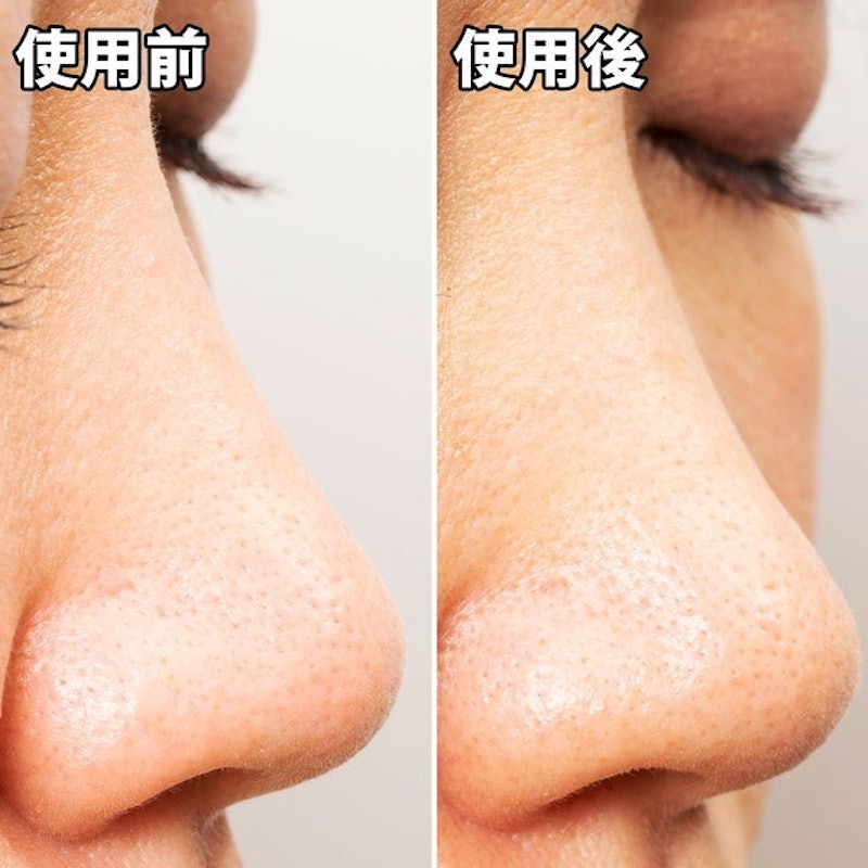 玩鼻親綠茶緊緻鼻膜 7