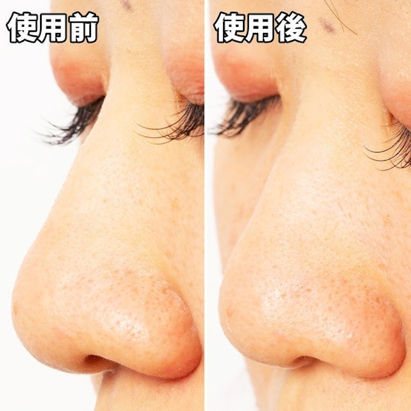 毛穴問題 凝膠型撕式鼻膜 6
