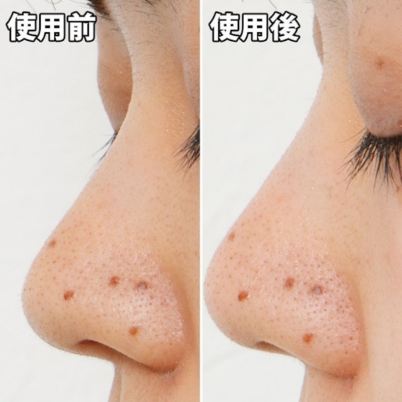 毛穴問題 凝膠型撕式鼻膜 9