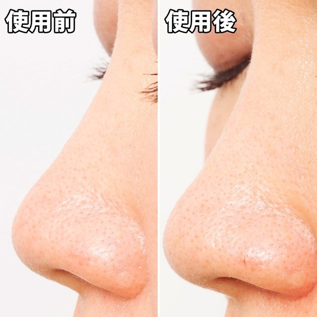玩鼻親綠茶緊緻鼻膜 6