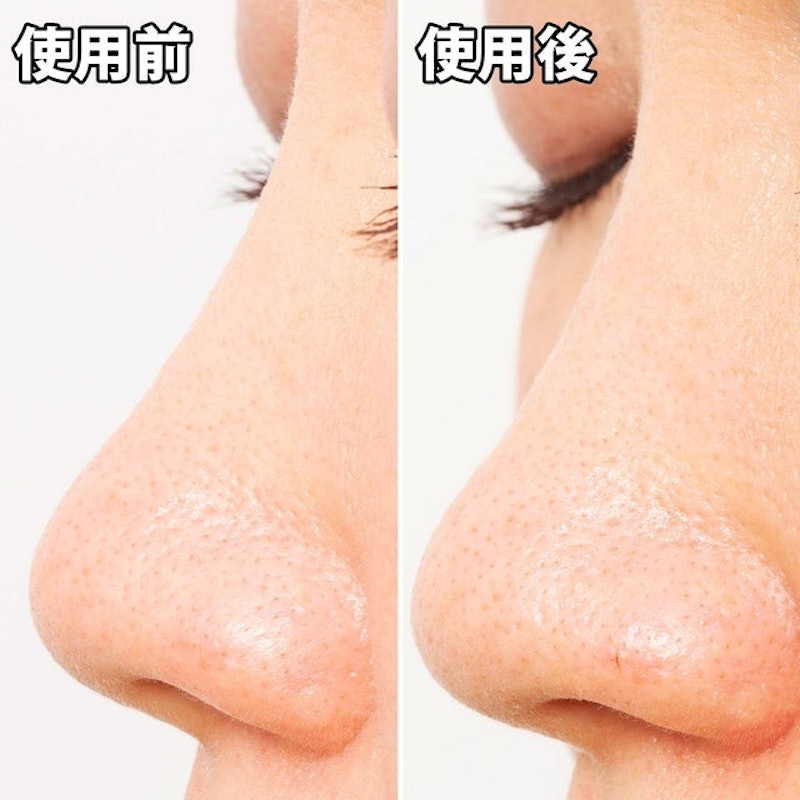 玩鼻親綠茶緊緻鼻膜 6