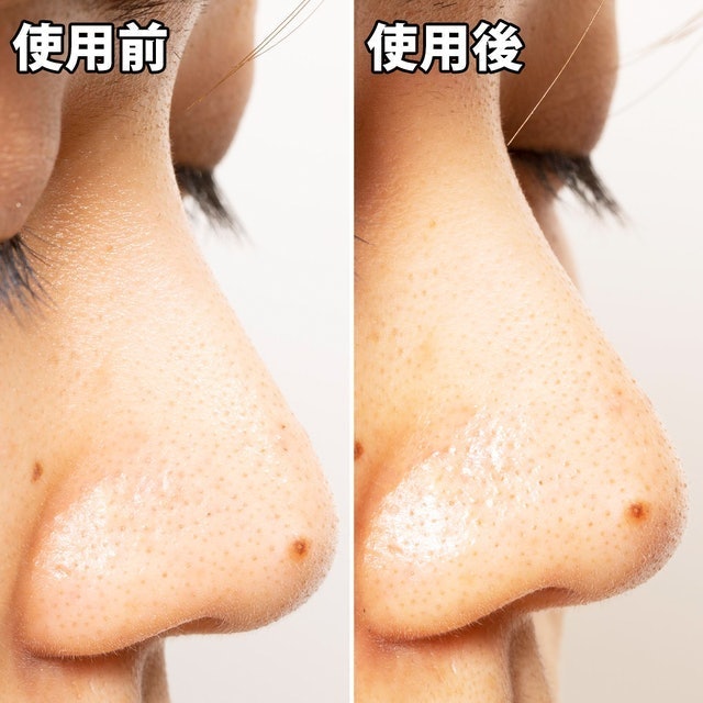 白金製藥 毛孔妙鼻貼炭貼布 10