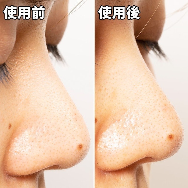 白金製藥 毛孔妙鼻貼炭貼布 10