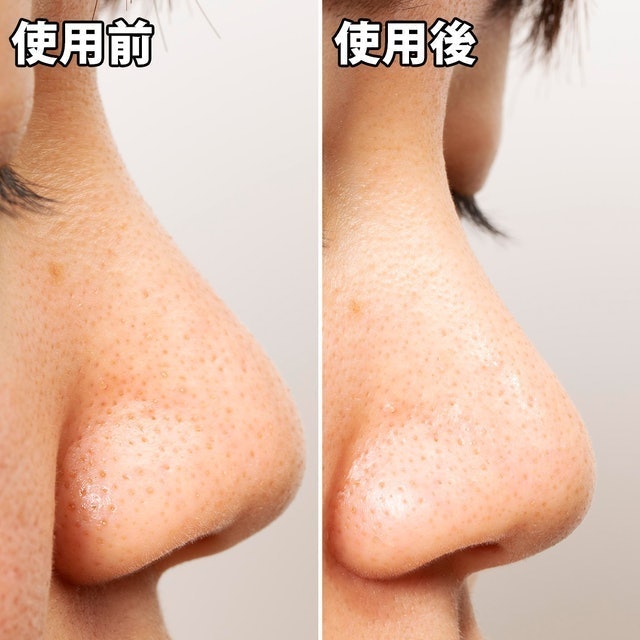 Pore’s Care 黑炭妙鼻貼 7