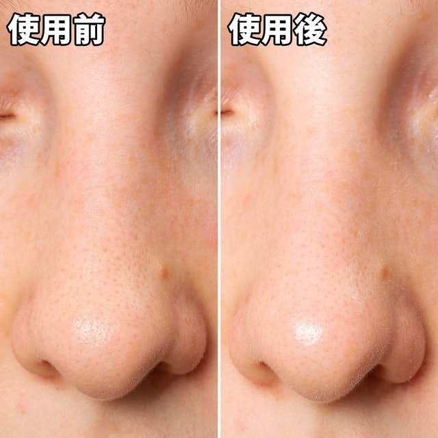 黑色妙鼻貼（女用） 5