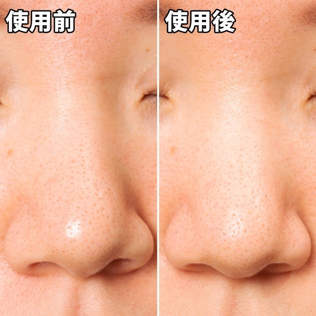 Pore’s Care 黑炭妙鼻貼 5